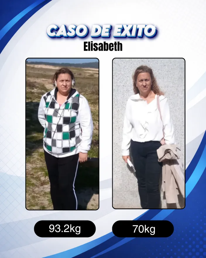 Antes y después de una clienta de Carlos Esteva