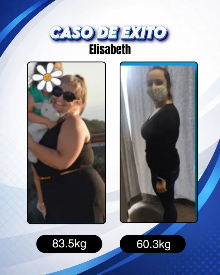 Antes y después de una clienta de Carlos Esteva