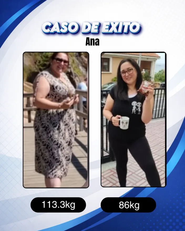 Antes y después de una clienta de Carlos Esteva