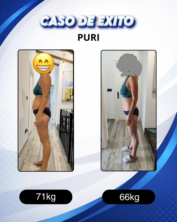 Antes y después de una clienta de Carlos Esteva