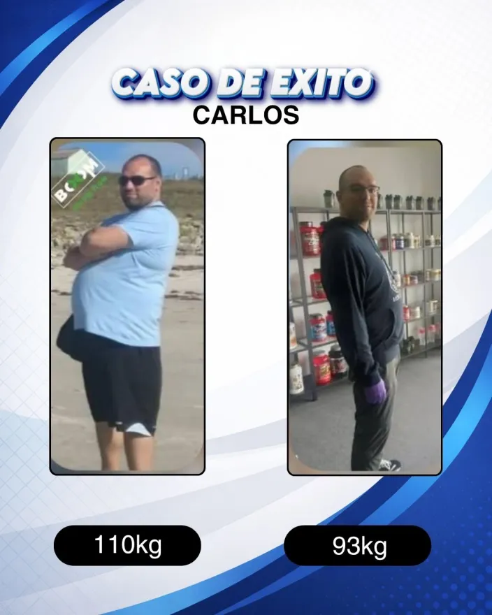 Antes y después de un cliente de Carlos Esteva: pérdida de grasa